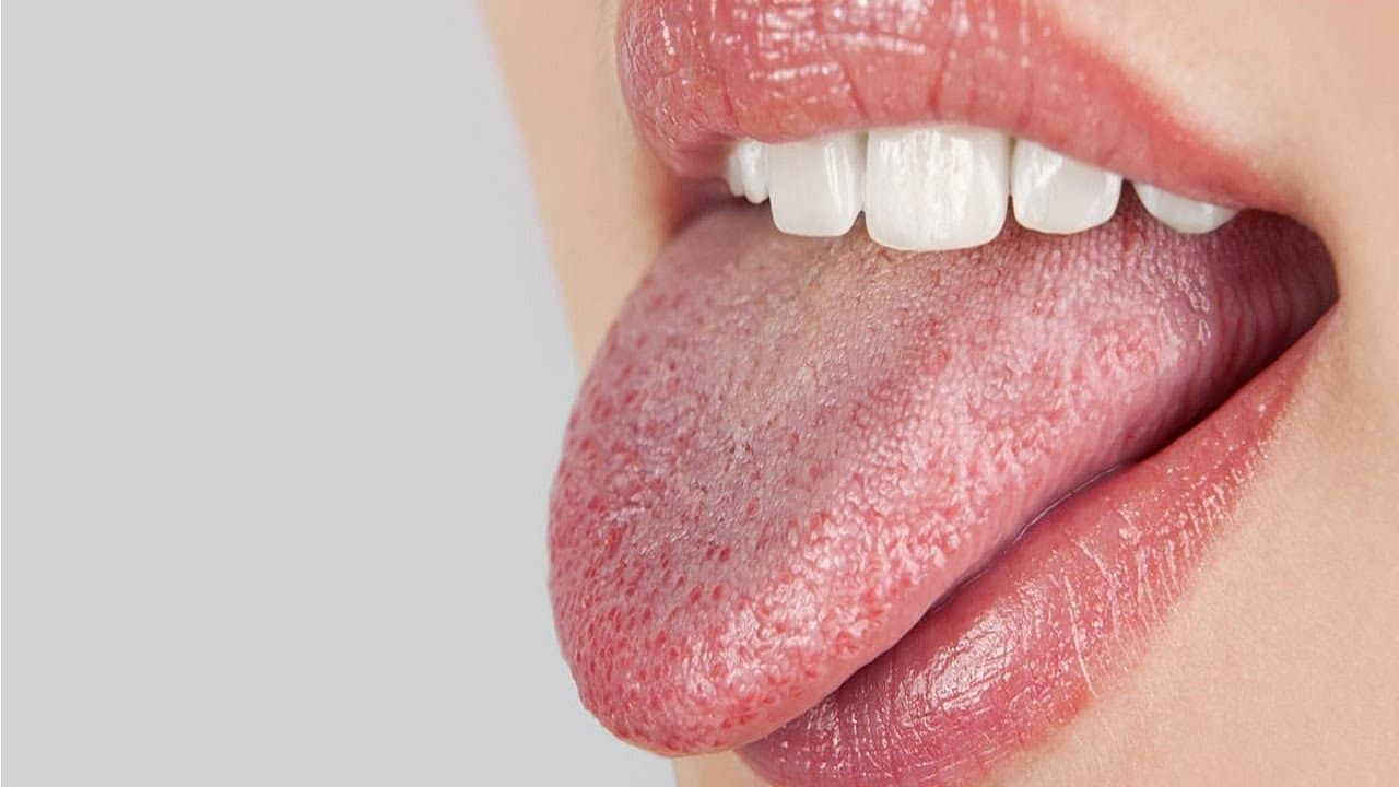 Xerostomia (Image via Getty Images)